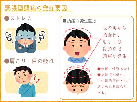 起床 頭痛 原因|寝起きの頭痛はなぜ起こる？後頭部やこめかみが痛む。